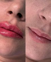 Estética Raphaela Santana imagen 15