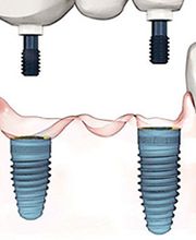 De Amsterdamse Tandarts afbeelding 7