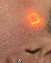 ALDERMA Praxis Klinik Dr. Titzmann Bild 9