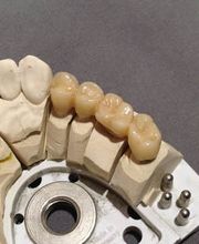 Dentallabor Kammin Bild 2