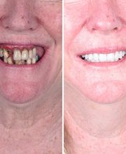 Britely Dentures + Implants Studio image 3