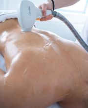 Dauerhafte Haarentfernung - Remove Laserzentrum Stuttgart Bild 4