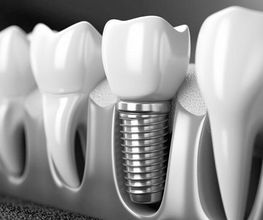 Dentallabor Grüttner GmbH Bild 7