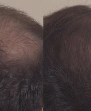 LEXUR GmbH - Manufaktur für Naturkosmetik Bild 4