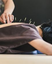 Acupuntura Yolanda Dorado imagen 7